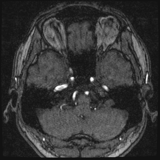 Click on the Serie image to view the images of VILLANUEVA, WILLIAM A.